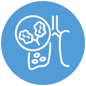 Pulmonary Fibrosis